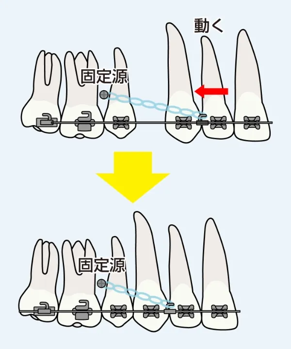 新しい選択肢 歯科矯正用アンカースクリュー