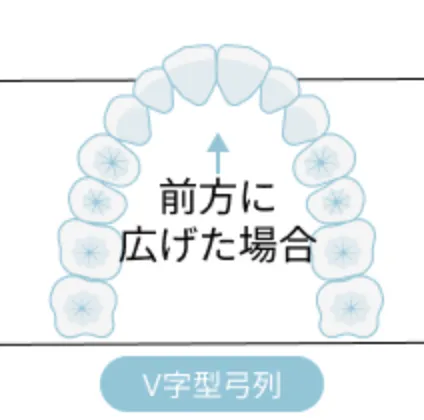 非抜歯治療（1）