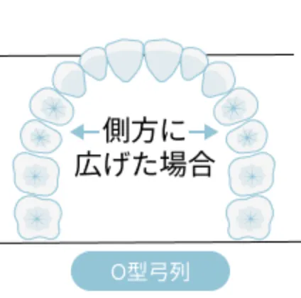 非抜歯治療（2）