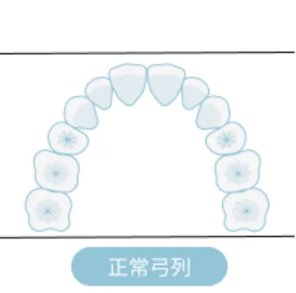 抜歯をした場合