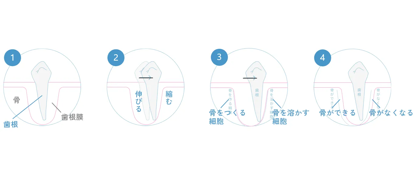 治療期間に関わる矯正の仕組み