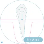 引っ込める