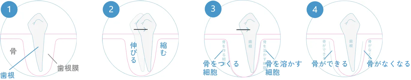治療期間に関わる矯正の仕組み