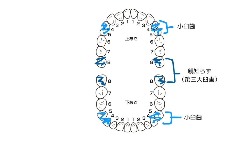 抜歯の部位
