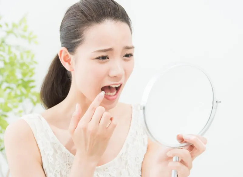 矯正治療後に歯が動くケース