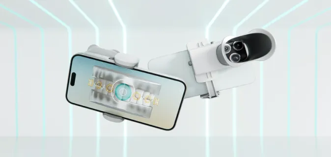 デンタルモニタリング