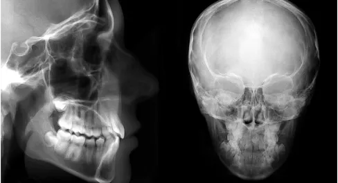 デジタル頭部X線規格写真（セファロ）とは